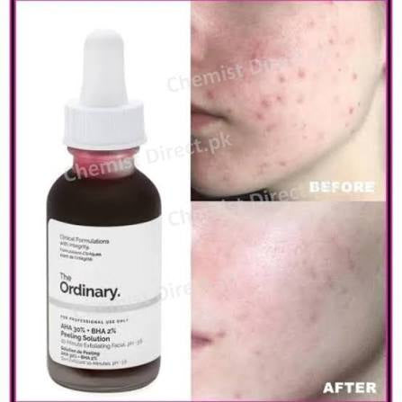 The Ordinary - AHA 30% +BHA 2% ( Peeling Solution)