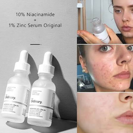 The Ordinary- Niacinamide 10%+Zinc 1%