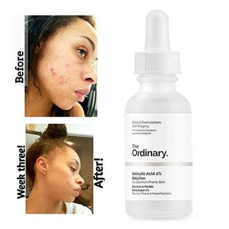 The Ordinary - Salicylic Acid 2% Acne Serum