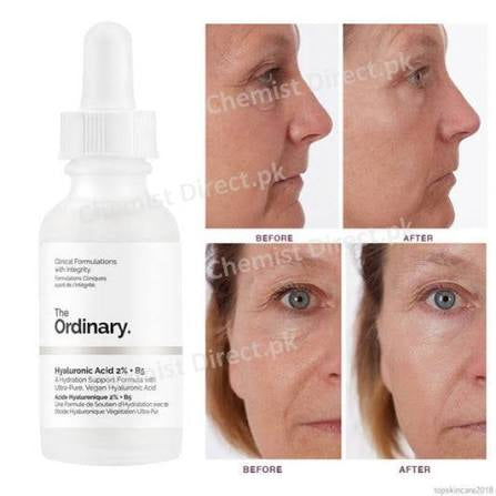 The Ordinary- Hyaluronic Acid 2% +B5